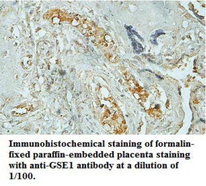Anti-GSE1 Antibody