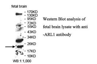 Anti-ARL1 Antibody Anti-ARL1 Antibody