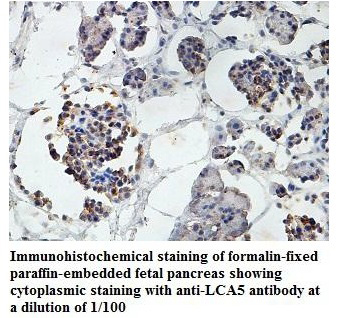 Anti-LCA5 Antibody