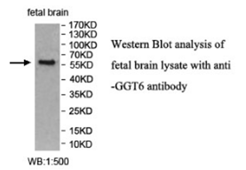 Anti-GGT6 Antibody