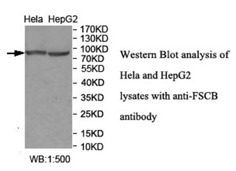 Anti-FSCB Antibody
