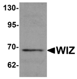 Anti-WIZ Antibody
