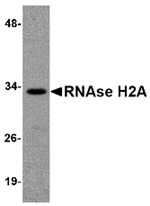 Anti-RNAse H2A Antibody