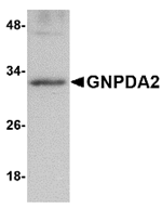 Anti-GNPDA2 Antibody