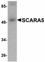 Anti-SCARA5 Antibody