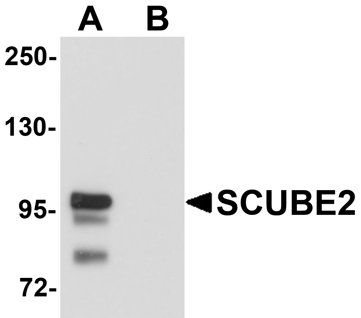 Anti-SCUBE2 Antibody