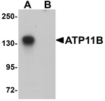 Anti-ATP11B Antibody