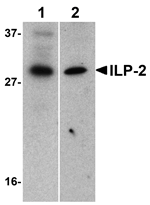 Anti-ILP-2 Antibody