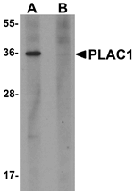Anti-PLAC1 Antibody
