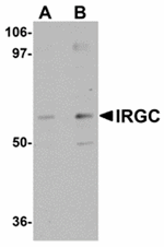 Anti-IRGC Antibody