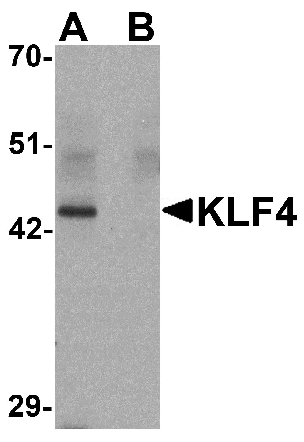Anti-KLF4 Antibody Anti-KLF4 Antibody