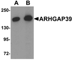 Anti-ARHGAP39 Antibody