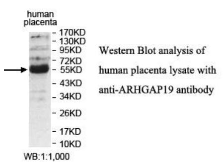 Anti-ARHGAP19 Antibody