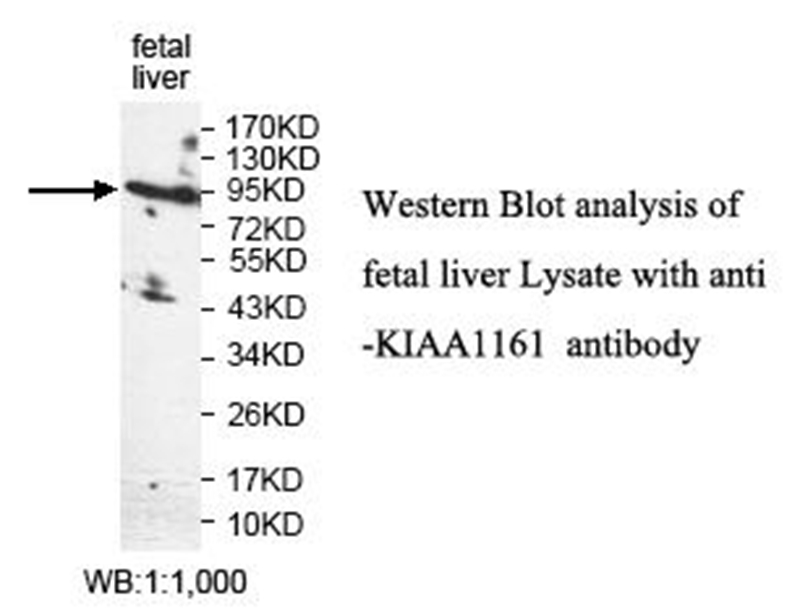 Anti-KIAA1161 Antibody