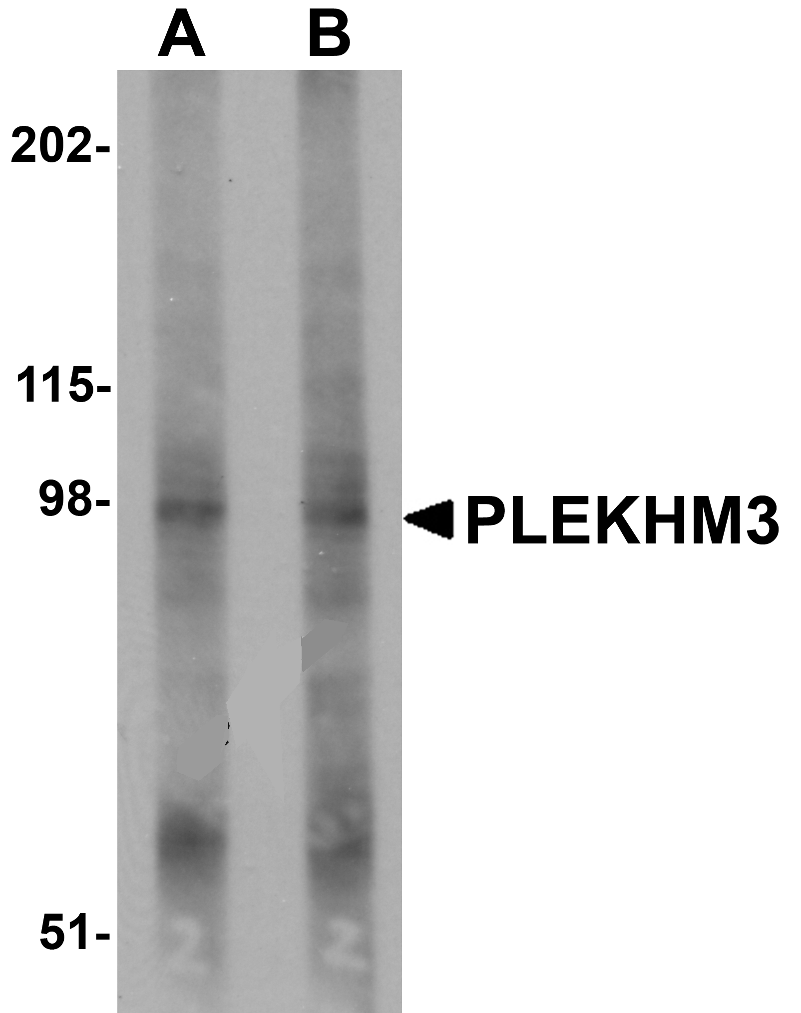 Anti-PLEKHM3 Antibody