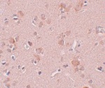 Anti-PLEKHM3 Antibody Anti-PLEKHM3 Antibody