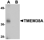 Anti-TMEM38A Antibody