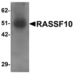 Anti-RASSF10 Antibody
