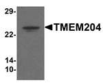 Anti-TMEM204 Antibody