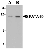 Anti-SPATA19 Antibody