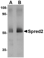 Anti-Spred2 Antibody