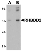 Anti-RHBDD2 Antibody