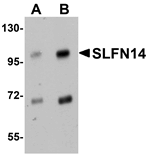 Anti-SLFN14 Antibody