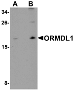 Anti-ORMDL1 Antibody