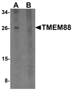 Anti-TMEM88 Antibody