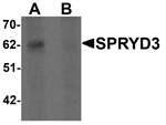 Anti-SPRYD3 Antibody