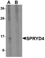 Anti-SPRYD4 Antibody