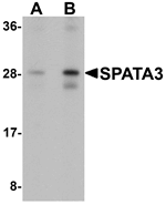 Anti-SPATA3 Antibody