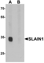 Anti-SLAIN1 Antibody