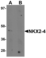Anti-NKX2-4 Antibody