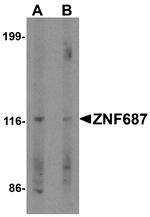 Anti-ZNF687 Antibody