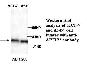 Anti-ARFIP2 Antibody