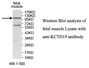 Anti-KCTD19 Antibody