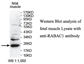Anti-RABAC1 Antibody