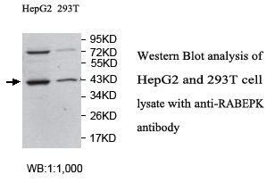 Anti-RABEPK Antibody