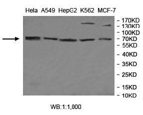 Anti-MGAT4A Antibody