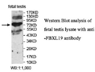 Anti-FBXL19 Antibody