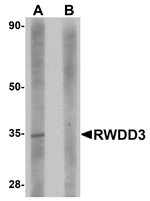 Anti-RWDD3 Antibody