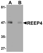 Anti-REEP4 Antibody