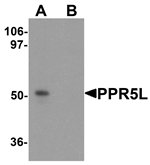 Anti-PRR5L Antibody