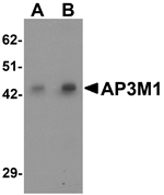 Anti-AP3M1 Antibody