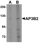 Anti-AP3B2 Antibody