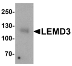 Anti-LEMD3 Antibody