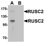 Anti-RUSC2 Antibody