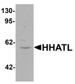 Anti-HHATL Antibody
