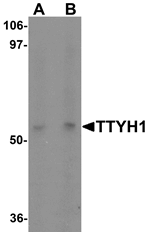 Anti-TTYH1 Antibody